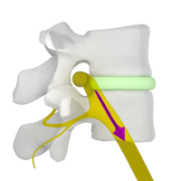 Figure 29a