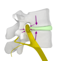 Figure 29b