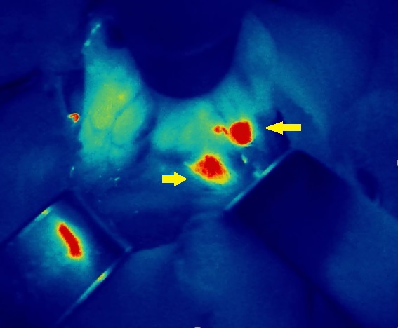 Autofluorescence