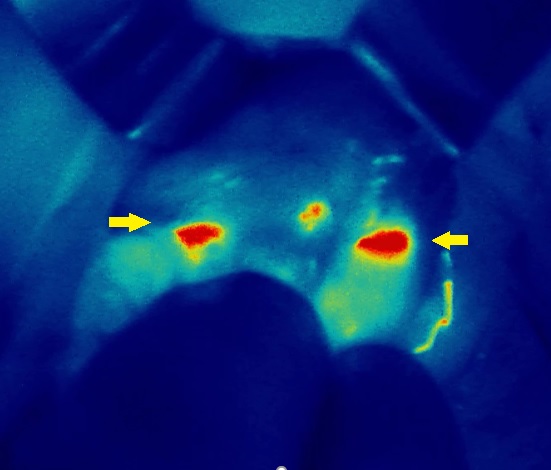 Autofluorescence