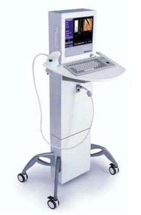 fibroscan