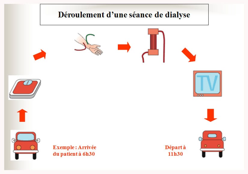 Hémodialyse